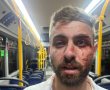 נהג אוטובוס פצוע בעדות מצולמת עם חבריו: "שלושה נערים תקפו אותי בנווה יעקב"